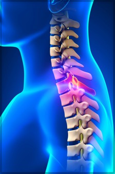 Whiplash Injury spinal example