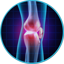 Knee Injury skeletal example